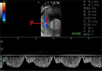 Circulatory and Metabolic Physiology Disorder in Different Organs of the Subtropical Scallop Species <mark class="highlighted">Chlamys nobilis</mark> Under Thermal and Hypoxia Stress, Revealed by Doppler Ultrasonography Technique